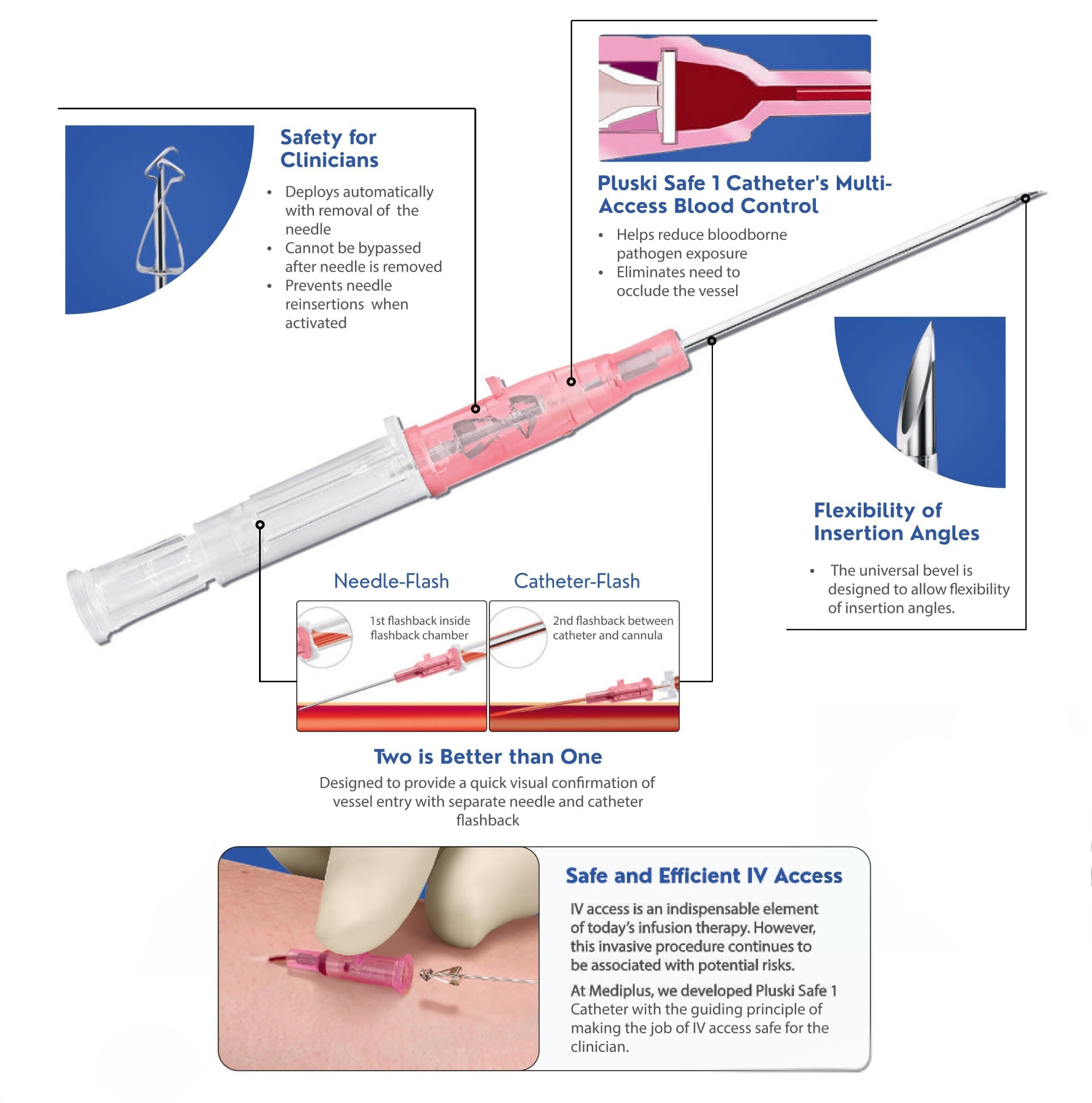 Image of the PLUSKI SAFE 1 IV Catheter highlighting its safety mechanism